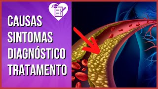 DISLIPIDEMIA Tipos Sintomas e Valores de Referência [upl. by Giardap]