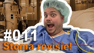 011  Stoma Revisie operatie vlog 12 [upl. by Agathy]