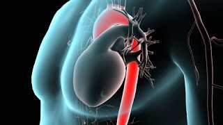 Anatomy of the Aorta [upl. by Ball]