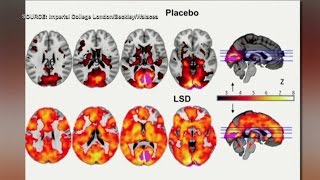 LSD study shows evidence of higher level of consciousness [upl. by Elatsyrk65]