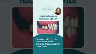 Consequências da perda dos dentes [upl. by Monah289]