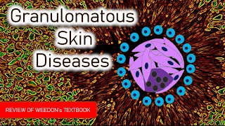 Dermatopathology Lesson 5 Granulomatous Skin Diseases Tissue Reaction Patterns [upl. by Yeloc]