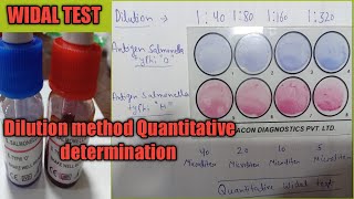 Widal Dilution test  Quantitative Widal test by slide method  Typhoid test करना सीखे [upl. by Malan]