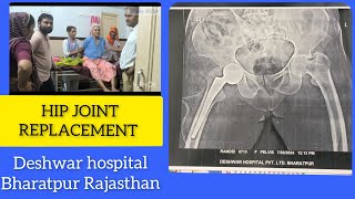 HIP JOINT REPLACEMENT कूल्हे के जोड़ का प्रत्यारोपण hipfracture jointpain [upl. by Enaoj847]