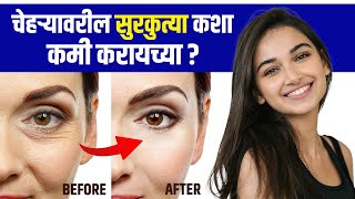 सुरकुत्या कमी कशा करायचे  How To Get Rid Of Face Wrinkles Quickly  Wrinkles Removal Home Remedy [upl. by Tail420]