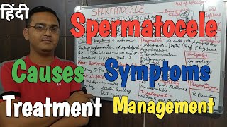 Spermatocele Causes and risk factorsSymptomsDiagnosisTreatment RinkeshPariyani [upl. by Brace]