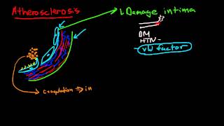 Pathophysiology of Atherosclerosis [upl. by Rowe]