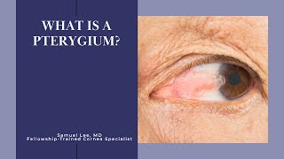 What is a Pterygium [upl. by Ja]