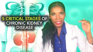 Stages of Chronic Kidney Disease CKD [upl. by Guarino]