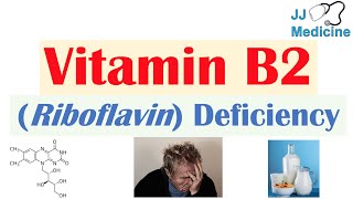 Vitamin B2 Riboflavin Deficiency  Food Sources Causes Symptoms Diagnosis and Treatment [upl. by Omixam]