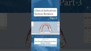 Clinical Indications Incisors Rotation Part 3 [upl. by Akemahs680]