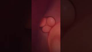 Bicuspid and Tricuspid valvesLub dub sounds of heart anatomy viralvideo yt youtube youtuber [upl. by Kendrah]