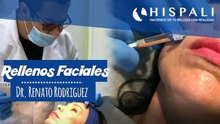 Relleno Facial Belotero y Xeomeen  Dr Renato Rodriguez [upl. by Estell]