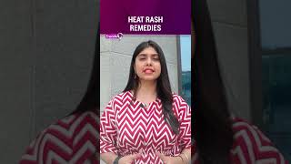 Heat Rash Remedies That Will Give Immediate Relief [upl. by Lomax]