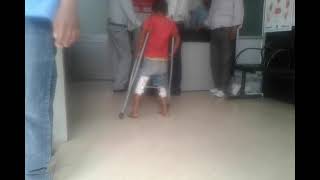 hip abduction brace for walking patient easily [upl. by Ayoted]