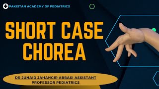 Short Case Chorea  Teaching on Patient [upl. by Melitta232]