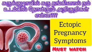 Ectopic pregnancy symptoms full explain in Tamilafter missed periods to start ectopicpregnancy [upl. by Bill328]