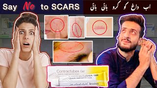 Contractubex Gel  Say “NO” to SCARS  Get rid fo scars Quickly  Merz Pharma Germany 🇩🇪 [upl. by Lleinnad]