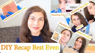 Monthly DIY Recap Innotox HanHeal Exosome Liporase HanHeal Hair Filler  PDOThreadsDIY [upl. by Yanetruoc]