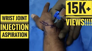 Wrist InjectionAspiration Technique [upl. by Martreb]