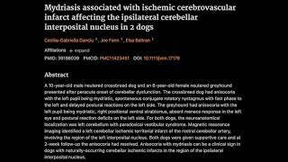 14 Mydriasis associated with ischemic cerebrovascular infarct affecting the ipsilateral cerebellum [upl. by Zerimar]