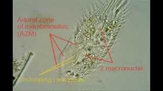 Tetmemena pustulata Stylonychia pustulata anatomy [upl. by Yrannav]