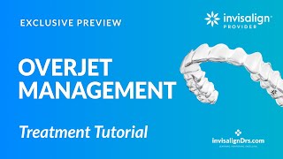 Overjet Management with Invisalign [upl. by Nwahsuq]