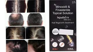 Minfin F5 Topical Solution Hair Regrowth Treatment Minoxidil amp Finasteride Topical Solution [upl. by Enairda511]