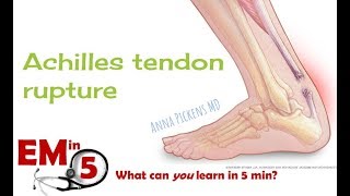 Achilles Tendon Rupture [upl. by Nylrac]