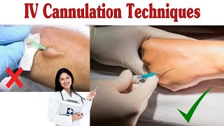 How To Insert IV Cannula  IV Cannulation Techniques [upl. by Nalon628]