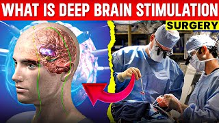 What is deep brain stimulation dbs  deep brain stimulation surgery  dbs surgery in hindi [upl. by Sivar]