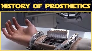 The Incredible Evolution of Prosthetic Technology [upl. by Aralc]