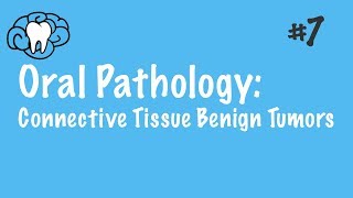 Oral Pathology  Connective Tissue Benign Tumors  INBDE ADAT [upl. by Jann]