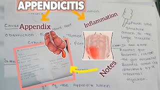 APPENDICITIS  BSC NURSING CAUSES PATHOPHYSIOLOGY SIGN AND SYMPTOMS MANAGEMENT [upl. by Ogdan]