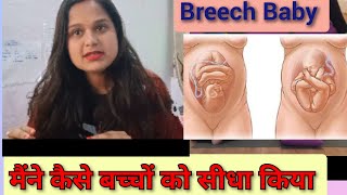 My breech baby story  kesa Kiya seedha  exercise baby position in Womb [upl. by Aenil]