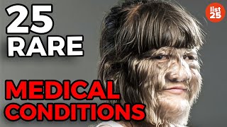 25 Rare Medical Conditions You Never Heard Of [upl. by Walston601]