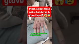 Jgn coba² gk pake glove klo GK mau kek gini ☠️😰 boxing boxingskill fight mma bangghalyh [upl. by Apicella]