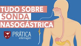 Não tenha mais DÚVIDAS sobre SONDA NASOGÁSTRICA [upl. by Wiburg]