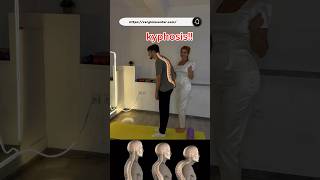 Try these kyphosis exercises to relieve pain and improve posture KyphosisRelief kyphosis [upl. by Goldston]