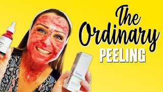 The Ordinary Peeling Resenha  Tratamento de Manchas [upl. by Revorg]