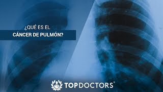 ¿Qué es el Cáncer de Pulmón [upl. by Awad]