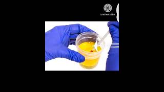 Microalbumin dipstick test urinalysis microalbuminuria science medical microscopic [upl. by Baryram917]