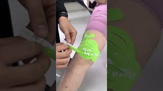 Use tape to treat lateral patellar ligament pain Iliotibial Band Syndrome in the knee [upl. by Euginimod]