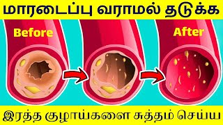 7 நாளில் இரத்த குழாய் கெட்ட கொழுப்பு அடைப்பு  Bad Cholesterol Removal Tamil [upl. by Decker]