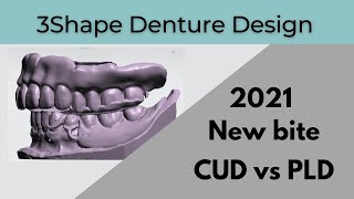 3Shape Denture Design Scan new bite for Complete Vs Partial design [upl. by Trebleht]