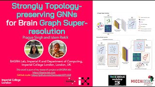 TopologyPreserving GNNs for Brain Graph SuperResolution  Distinguished MSc  PRIME MICCAI 2024 [upl. by Jammin]