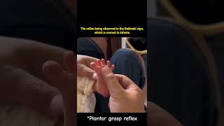 The plantar grasp reflex seen in infants occurs when the sole of the foot is gently pressed [upl. by Assilim]