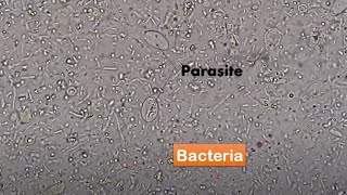 Bacteria and Parasites in stool Microscopy Live motile bacteria and cysts of Giardia lamblia [upl. by Cutler]