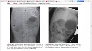 EMERGENCY RADIOLOGY REQUISITES [upl. by Agostino]