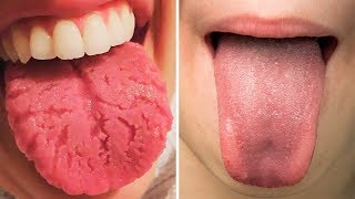 What Your Tongue Says About Your Health [upl. by Morville]